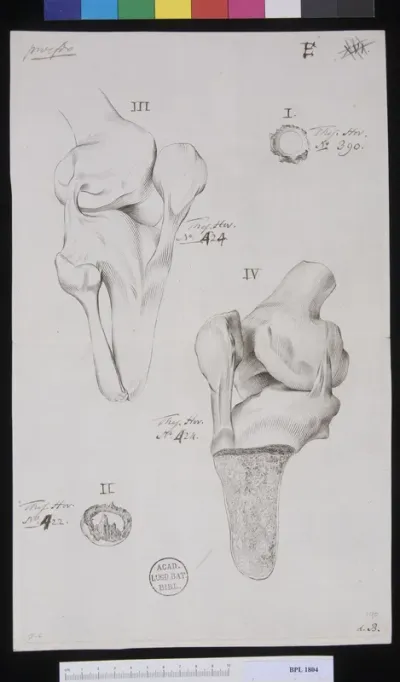 Pathology, fractures (Knee)