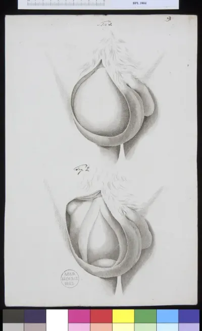 Pathology, fractures (testicles)