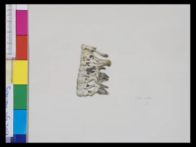 Pathology, vertebrae