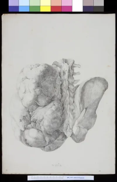 Pelvis, dorsal view