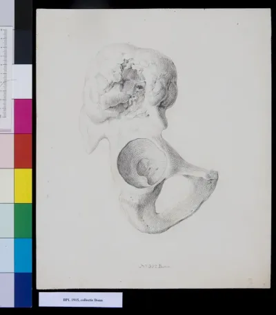 Pelvis