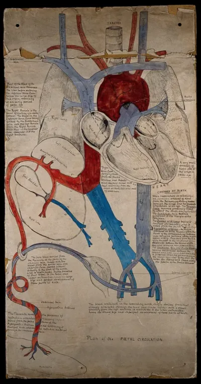 Plan of foetal circulation