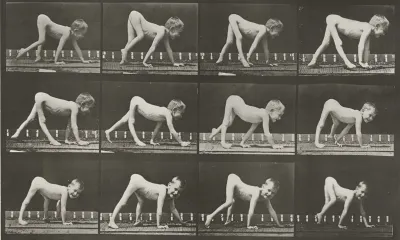 Plate Number 539. Infantile paralysis, child walking on hands and feet