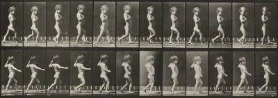 Plate Number 540. A: Bowlegs, boy. B: Spinal caries, girl walking