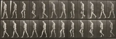 Plate Number 555. Muscular atrophy of legs, adult, walking