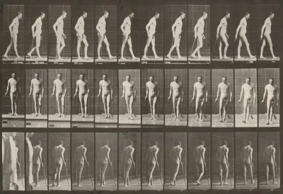 Plate Number 559. Partial paraplegia, walking with cane
