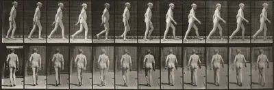 Plate Number 562. Lateral curvature of spine, walking