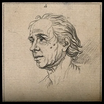 Profile of a man displaying a phlegmatic-melancholic temperament