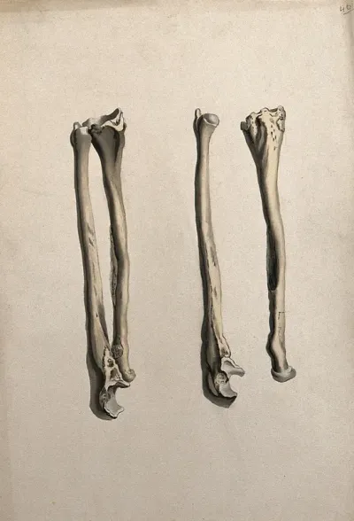 Radius and ulna bones: two figures