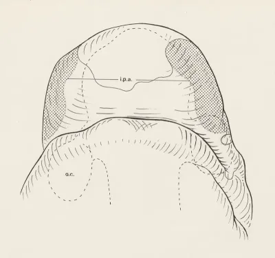 Reconstruction of the nose of an embryo
