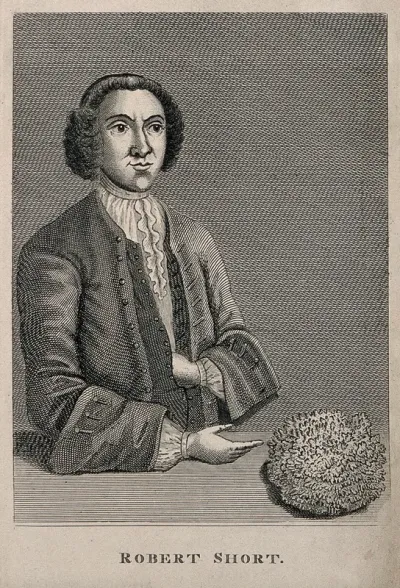 Robert Short, who had a bladder-stone removed which was eight inches in circumference