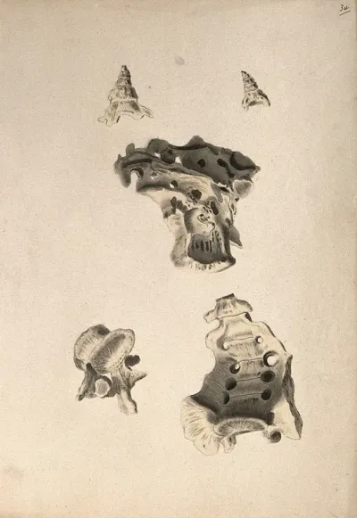 Sacrum: five figures