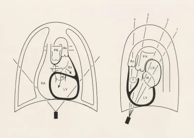 Schematic representation of the heart and circulatory system