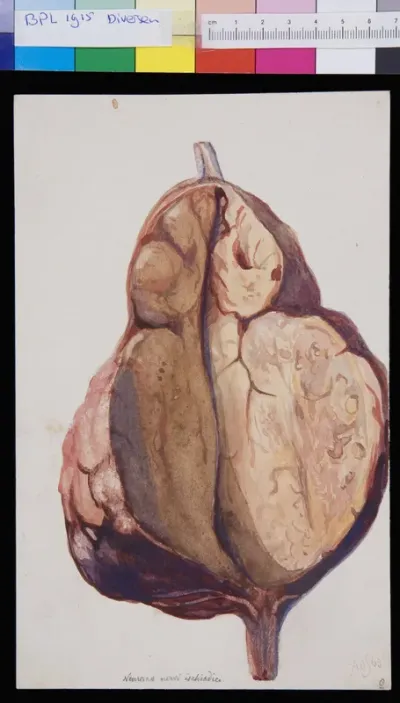 Sciatic veins