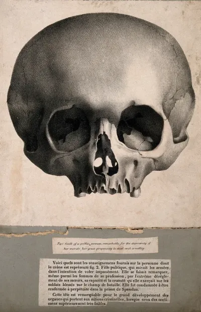 Scull of a public woman, remarkable for the depravity of her morals, her great propensity to steal and cruellty