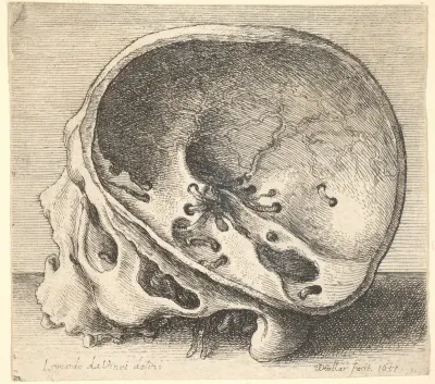 Sectioned skull in profile to left with the left side of the cranium removed