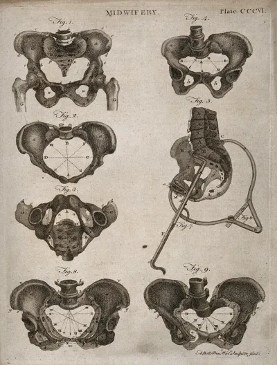 Seven diagrams of differently shaped pelvises and their measurements