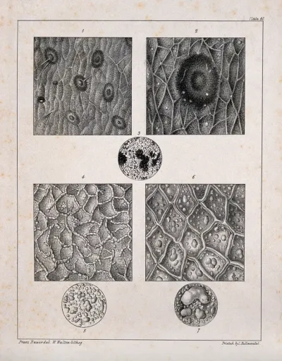 Several examples of skin disease