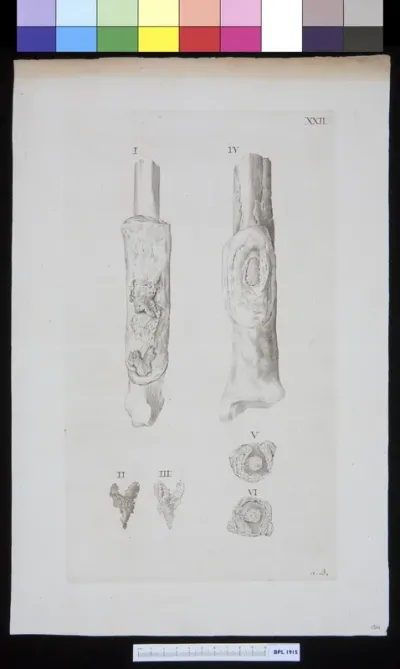 Several views of infected bones