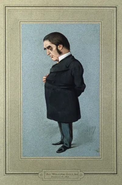 Sir William Withey Gull