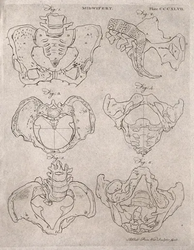 Six diagrams of differently shaped pelvises