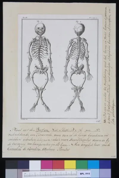 Skeleton with broken joints
