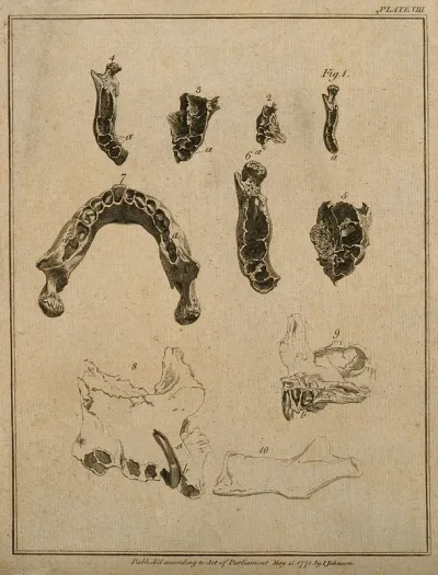 Skull and jaw bones, with teeth: ten figures