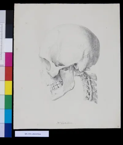 Skull and vertebrae, lateral view