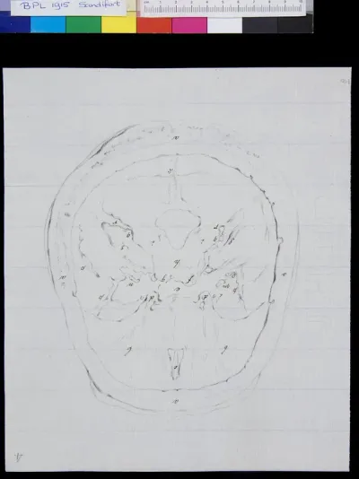 Skull (calvaria), view from inside (legend)