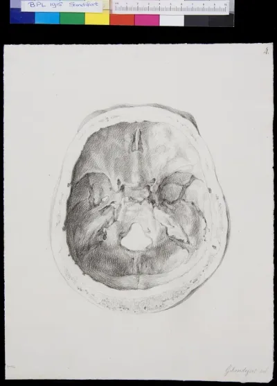 Skull (calvaria), view from inside