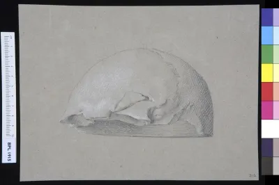 Skull (frontal and parietal)