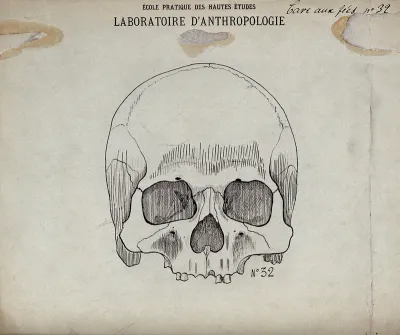 Skull (human ?): front-view