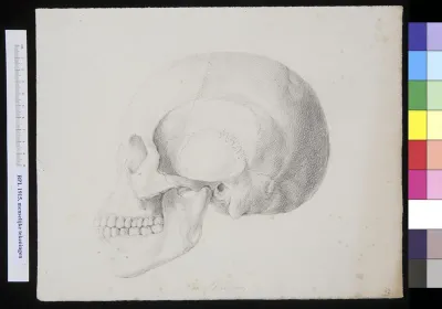 Skull of a man of woman from Darfour, lateral view
