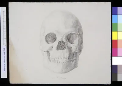 Skull of a man or woman from Darfour, frontal view