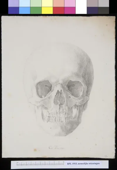 Skull of a man or woman from Turkey, frontal view