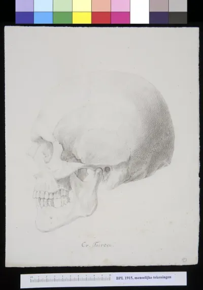 Skull of a man or woman from Turkey, lateral view