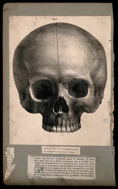 Skull of a soldier: frontal view