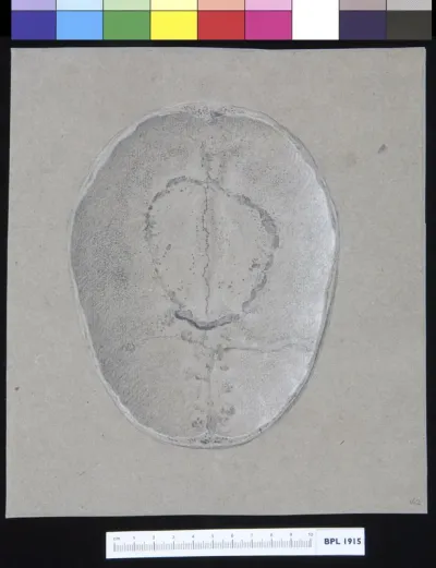 Skull, parietal and frontal, interior view