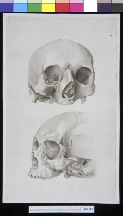 Skull (two views)