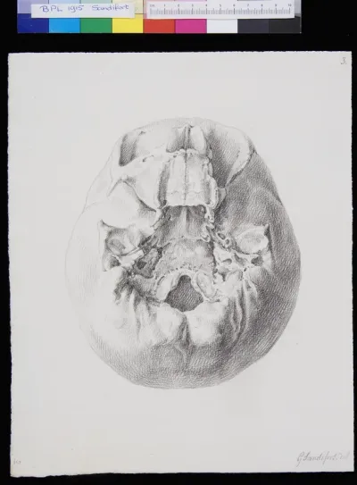 Skull, view from below