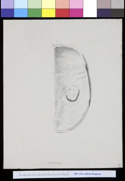 Skull with a hole, interior view