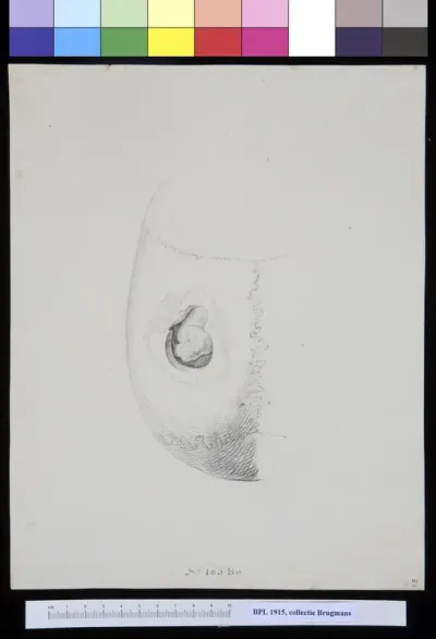 Skull with a hole, view from above