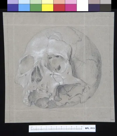 Skull with fractures
