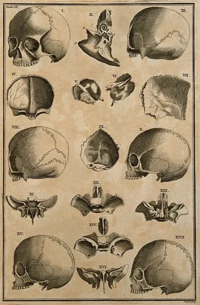 Skulls and skull fragments, showing different shapes of skulls and variations in sutures, after Eustachius