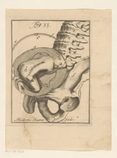 Stuitligging van een foetus