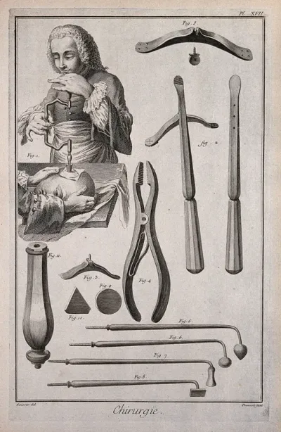 Surgery: above, a skull being trepanned; below, various instruments used in trepanation