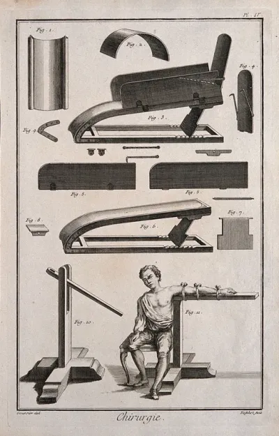 Surgery: an assortment of surgical instruments, including a contraption for complex fractures and a machine for the luxation of dislocated arms
