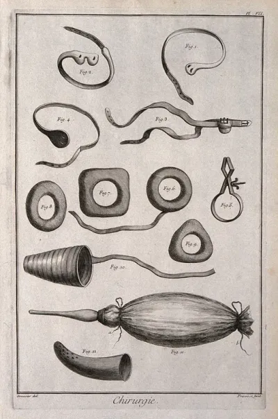 Surgery: an assortment of surgical instruments, including an instrument for the dilation of the foreskin, a cannula and a syringe for the bladder