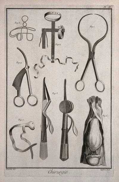 Surgery: an assortment of surgical instruments including tweezers known as "Helvetian tweezers" for cancer operations, and instruments and contraptions for the correction of rickets