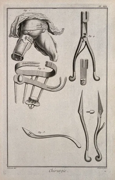 Surgery: instruments for the amputation of limbs, including chisels and needles